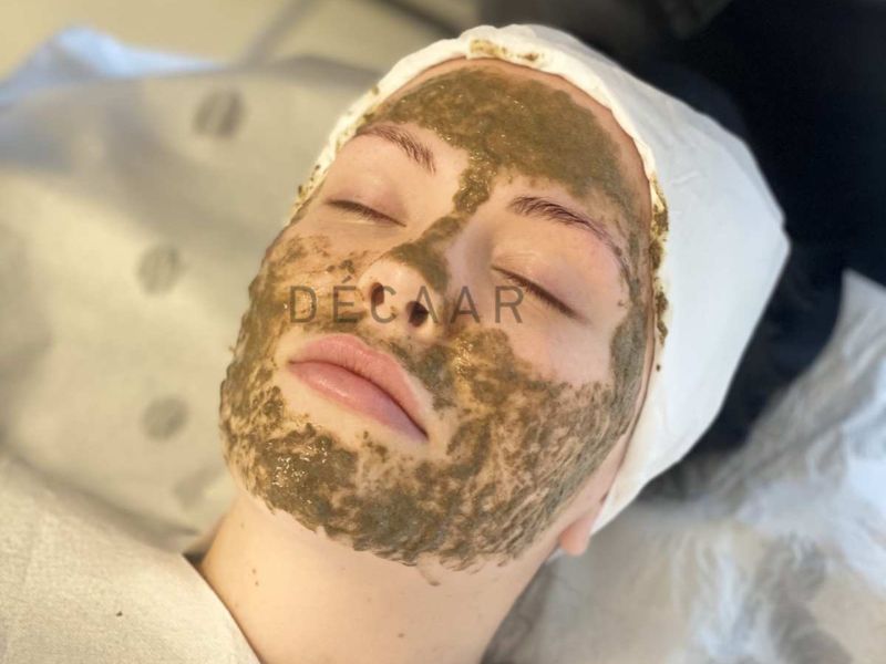 Peel tảo Décaar